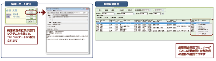 画面イメージ。病理検査の結果が部門システムから届くと、コミュニケートに通知されます。病理照会画面では、オーダごとに結果確認/患者説明の進捗が確認できます。
