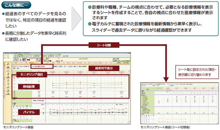 画面イメージ。経過表のすべてのデータを見るのではなく、特定の項目の経過を確認したい時や長期に分散したデータを素早く時系列に確認したい時…診療科や職種、チームの視点に合わせて、必要となる診療情報を表示するシートを作成することで、各自の視点に合わせた医療情報が表示されます。 また、電子カルテに蓄積された診療情報を最新情報から素早く表示し、スライダーで過去データに遡りながら経過確認ができます。